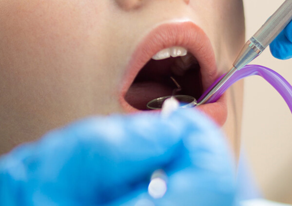 A woman is having pain-free dentistry dental treatment.