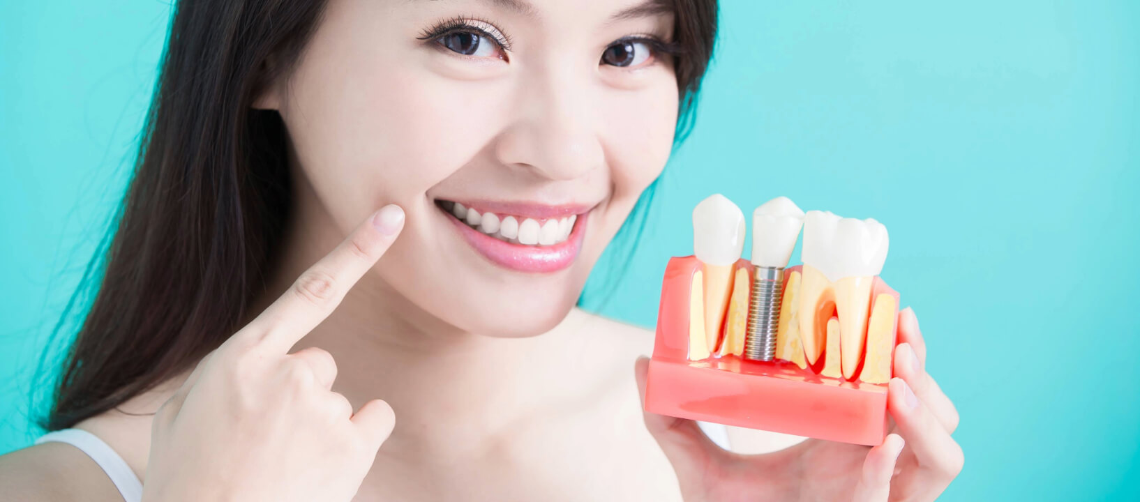 Affordable Dental Implants in Maryville IL area